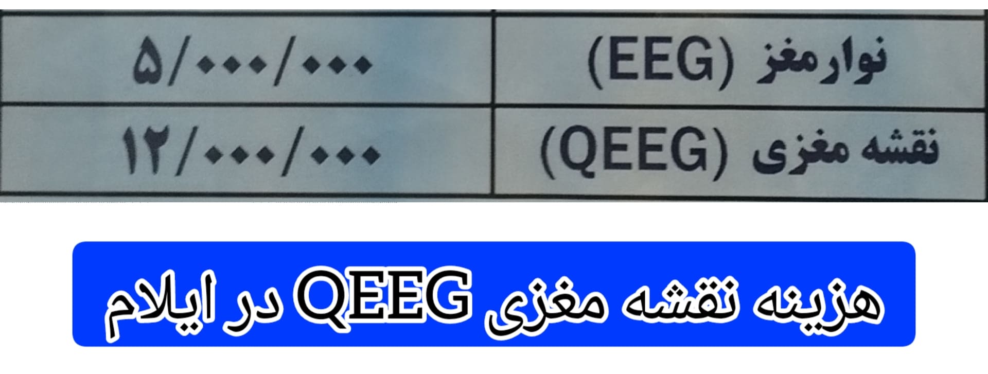 هزینه-نقشه-مغزی-در-ایلام