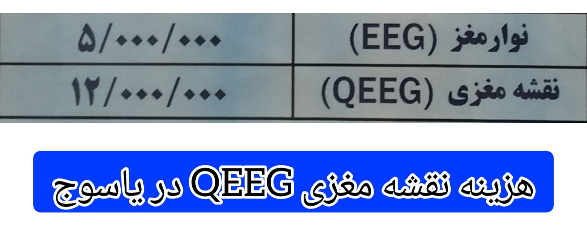هزینه-درمان -نقشه-مغزی- در-یاسوج