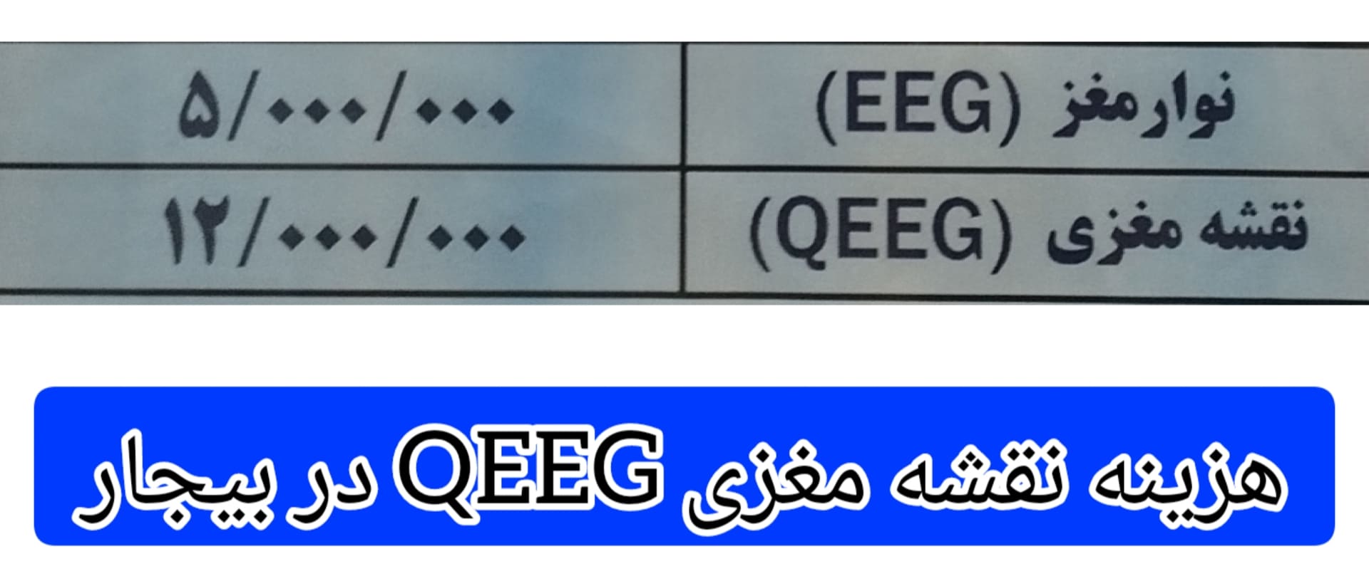 هزینه-انجام-نقشه-مغزی-QEEG-در-بیجار