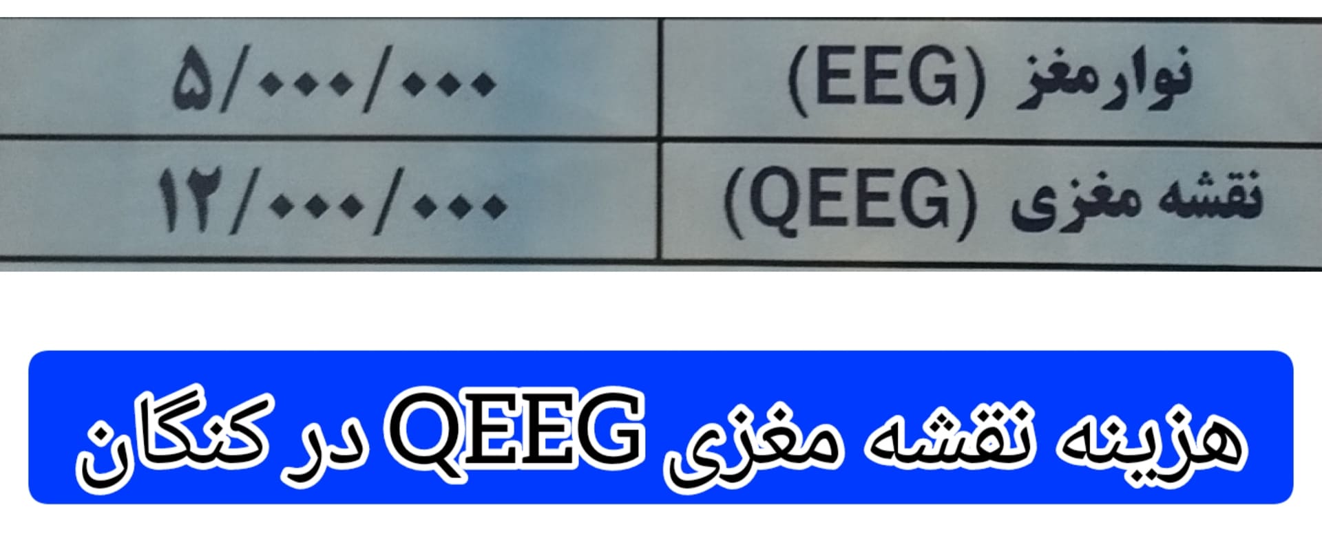 هزینه-انجام-نقشه-مغزی-QEEG-در-کنگان
