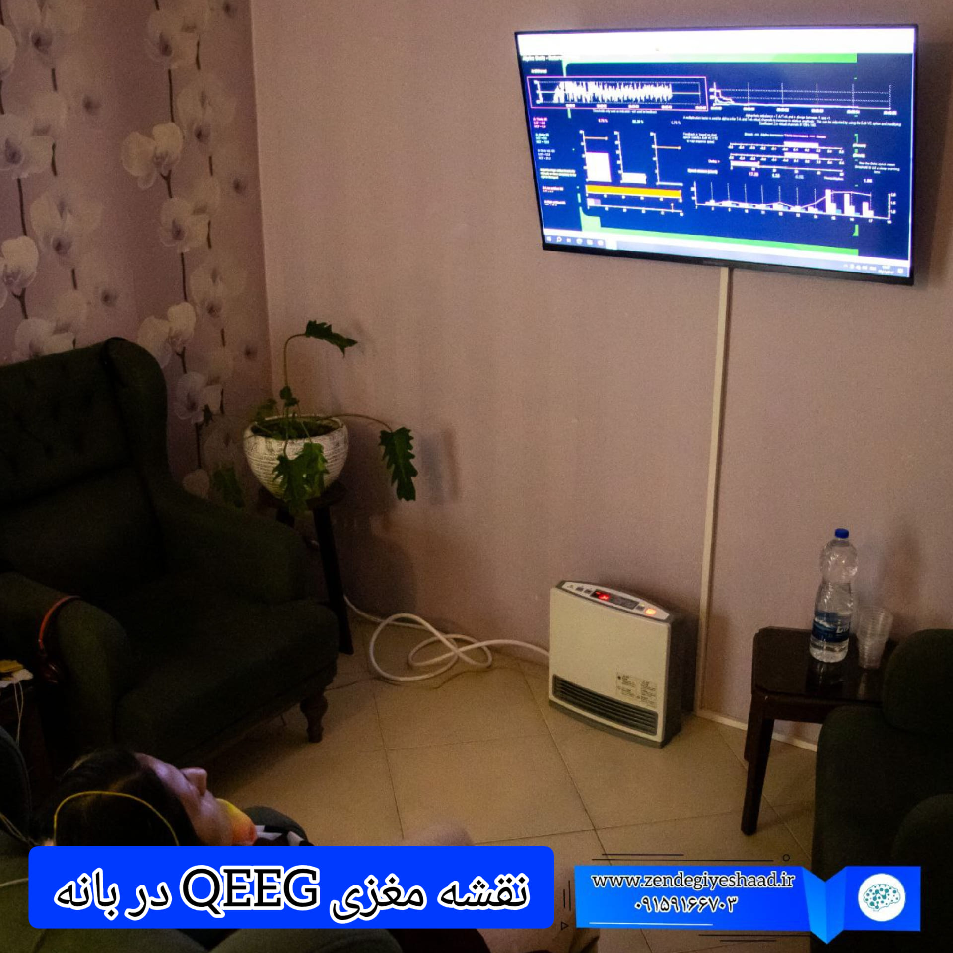 نقشه-مغزی-QEEG-در-بانه