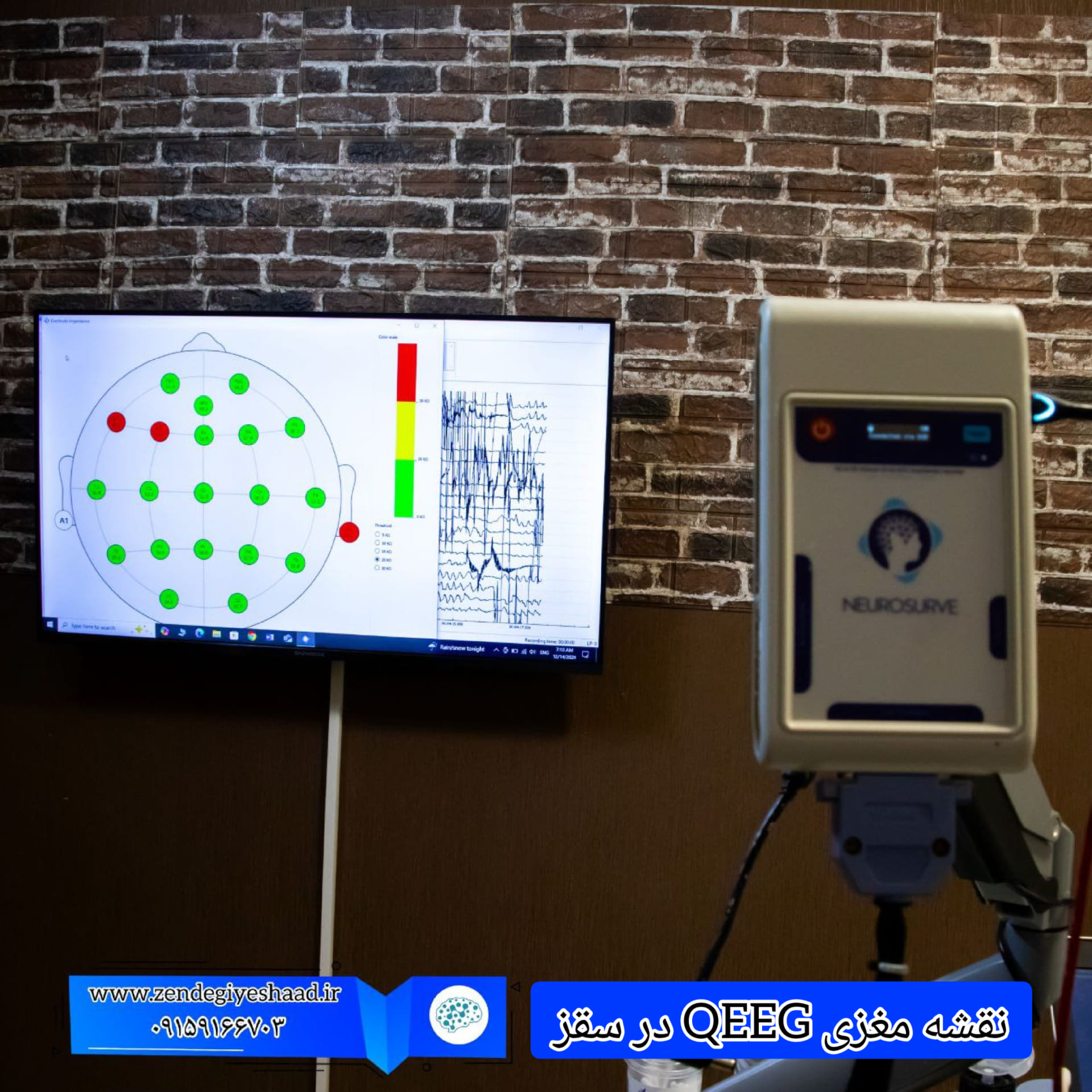 اهمیت-نقشه-مغزی-QEEG-در-سقز