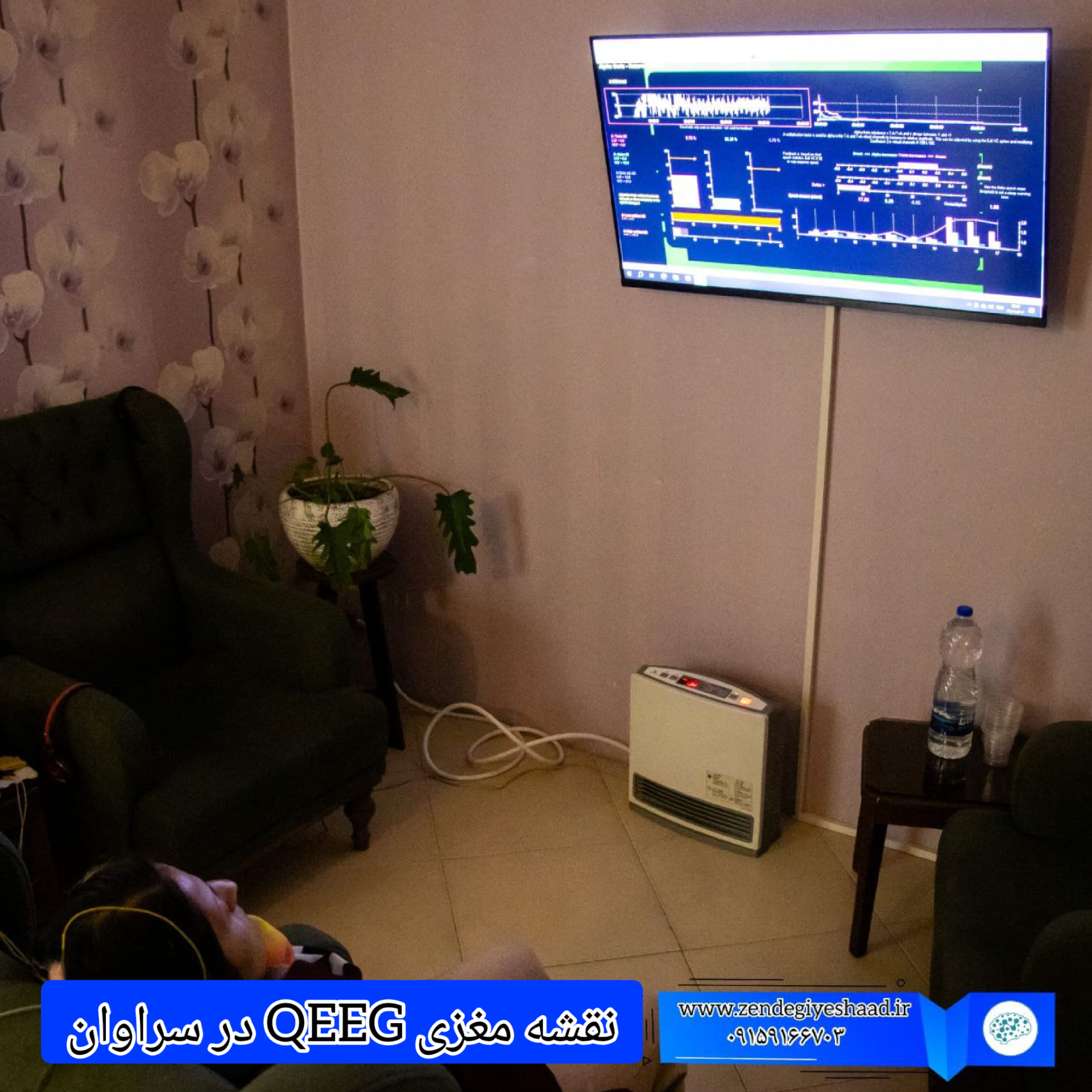 نقشه-مغزی-QEEG-در-سراوان