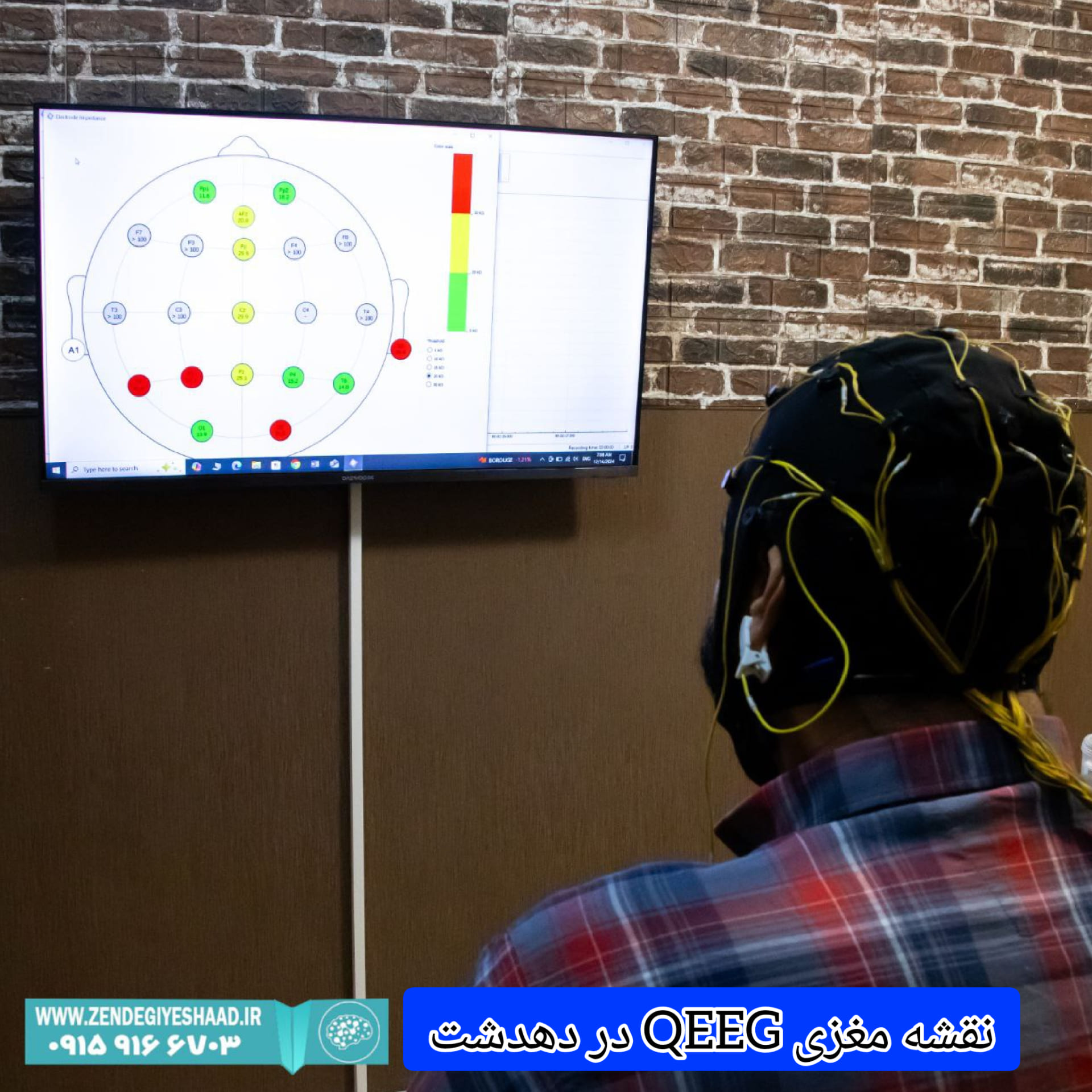 نحوه-انجام-نقشه-مغزی-QEEG-در-دهدشت