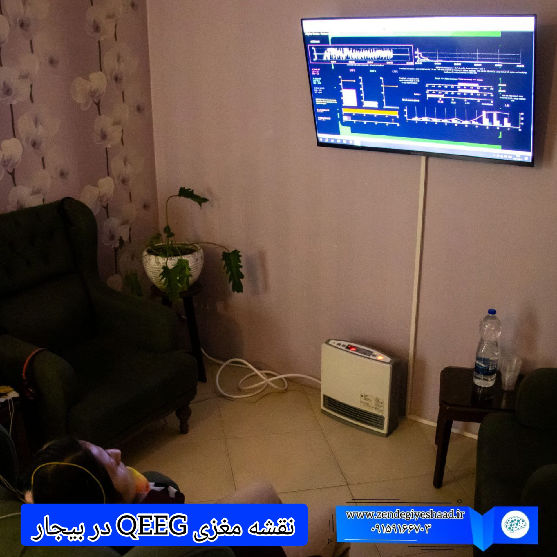 نقشه-مغزی-QEEG-در-بیجار