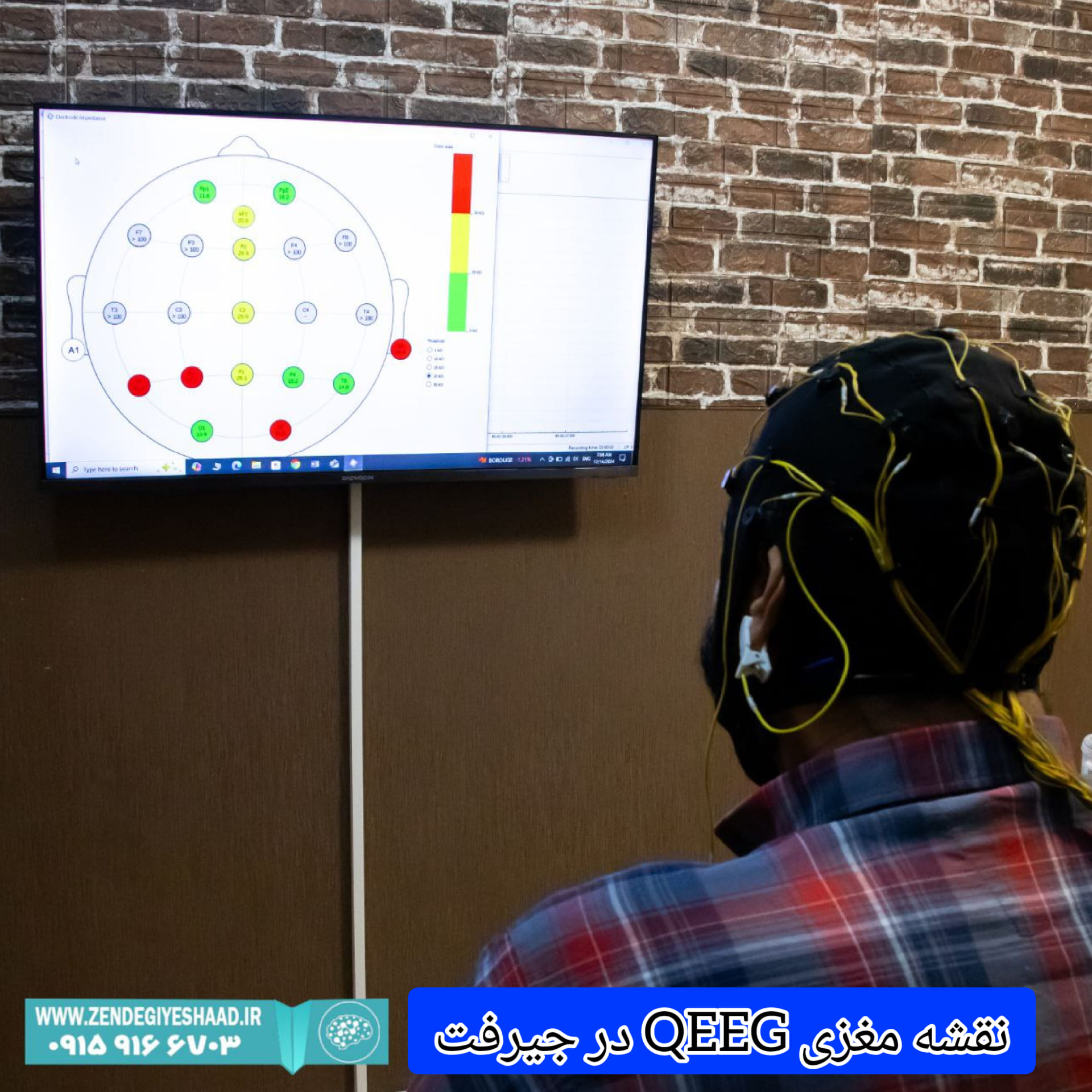 کاربرد-نقشه-مغزی-QEEG-در-جیرفت